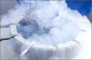 液氮冷凍低溫粉碎機(圖8)